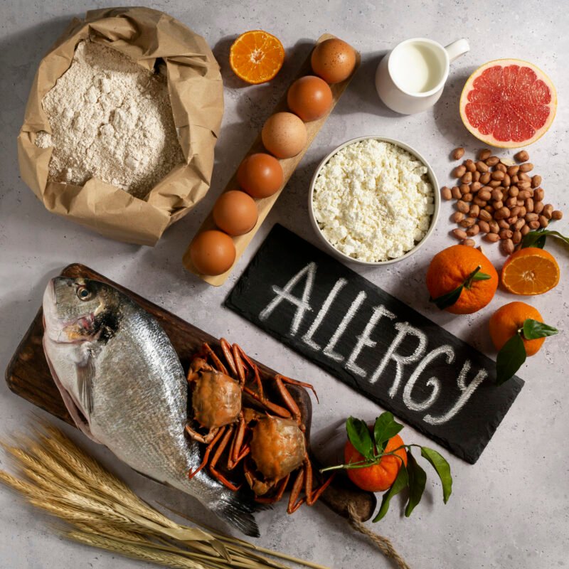 Egzaa , allergy